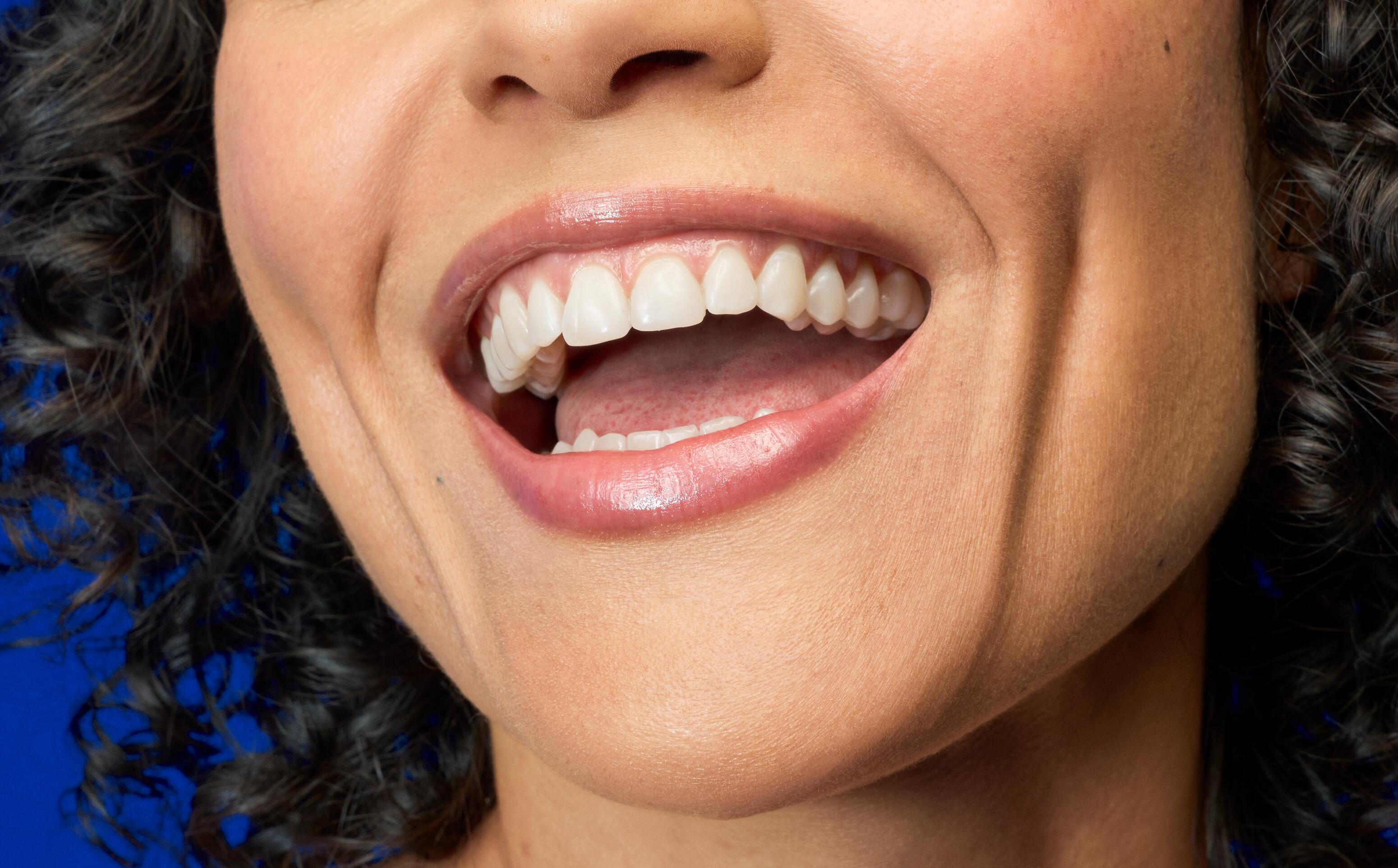 OC_ELGYDIUM_MULTI-ACTION TOOTHPASTE_STATIC _BEAUTY RESULT_CLOSE_UP_16x9_2025_3577056027611